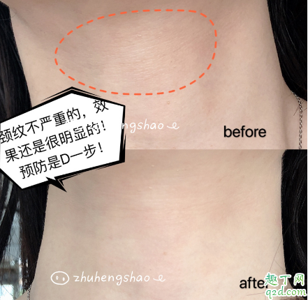 米加頸霜有沒有效果 米加頸霜使用評測4