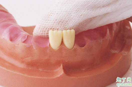 寶寶出牙會(huì)有低燒嗎 小孩先長上牙還是下牙3