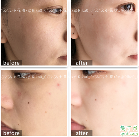 貝歐夢特谷胱甘肽美白精華怎么樣 貝歐夢特美白精華使用感受5