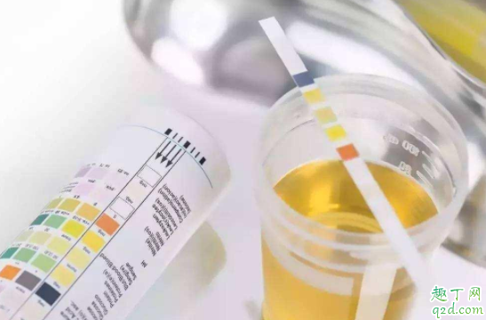 孕期不胖可以不做糖篩嗎 糖篩什么時候做多少周2