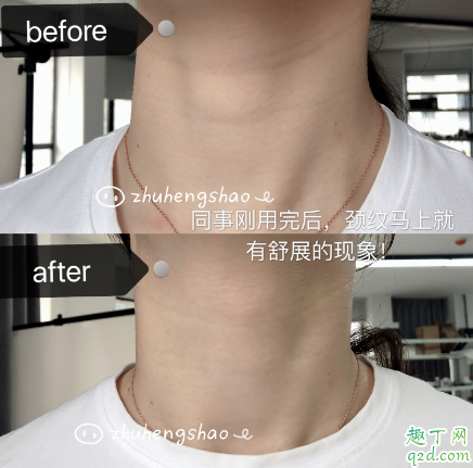 米加頸霜有沒有效果 米加頸霜使用評測5